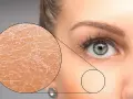 Trockene Gesichtshaut: Ursachen, Symptome und effektive Behandlungsmöglichkeiten