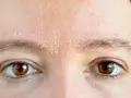 Trockene Gesichtshaut bei Männern: Ursachen, Symptome und Pflege Tipps