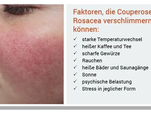 Rote Gesichtshaut: Ursachen, Symptome und wirksame Behandlungen