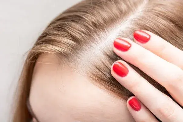 Dünnes Haar und sichtbare Kopfhaut bei Frauen: Ursachen und Lösungen