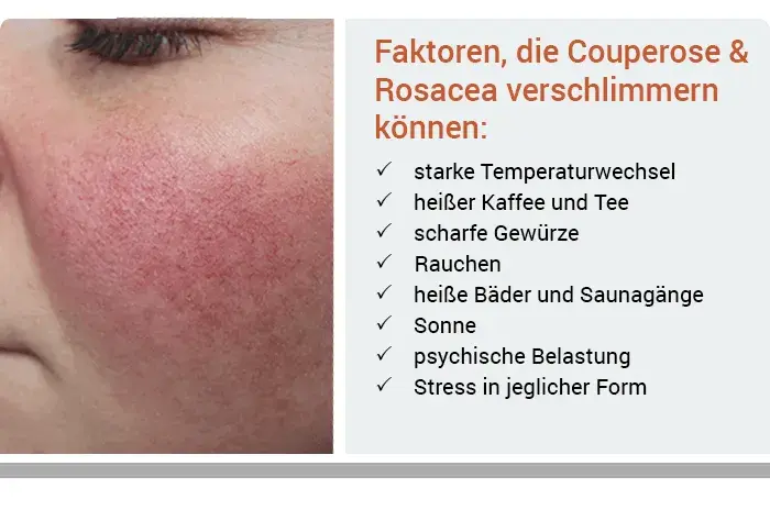 Rote Gesichtshaut: Ursachen, Symptome und wirksame Behandlungen