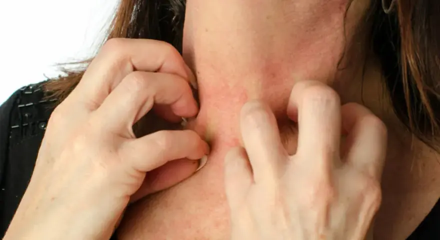Allergie Parfum Symptome: So erkennen Sie die gefährlichen Anzeichen